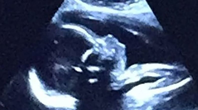 Devina Rolle, a Jonesboro mother-to-be, is one of thousands of women who have recently turned to crowdfunding to support themselves while on maternity leave.