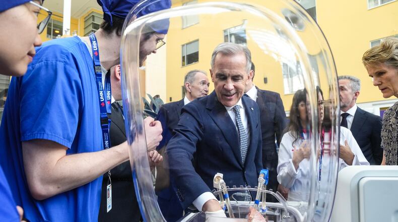 Prime Minister Mark Carney inspects a pig's lungs during an AI demonstration as they visit Toronto General Hospital on Thursday, June 4 2026. (Chris Young /The Canadian Press via AP)