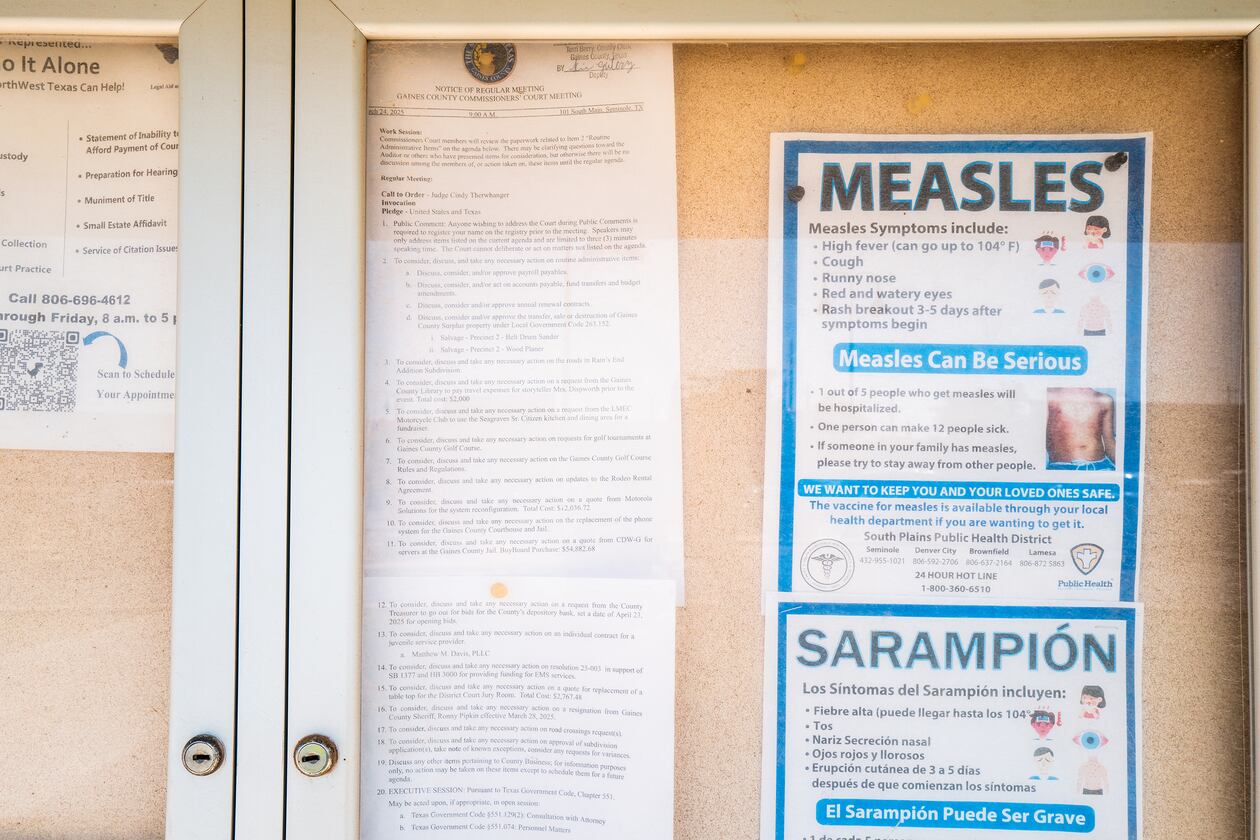 The CDC says there have been 1,514 measles cases reported in the U.S. as of Tuesday, including a large outbreak in west Texas and New Mexico in April that led to the deaths of two unvaccinated children and an unvaccinated adult. (Brandon Bell/TNS 2025)