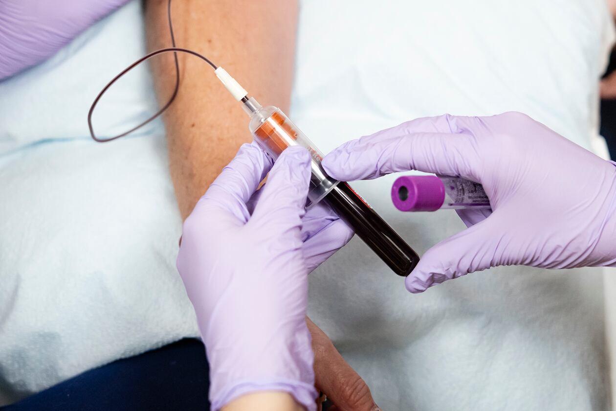 A blood sample can be used to measure A1C, a test that offers a picture of average blood sugar levels over the past two to three months. (Eva Marie Uzcategui/The New York Times)