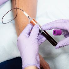 A blood sample can be used to measure A1C, a test that offers a picture of average blood sugar levels over the past two to three months. (Eva Marie Uzcategui/The New York Times)