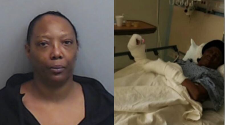 Sandy Mathis (left) is accused of using a hammer to assault her 94-year-old mother Willie Monroe, breaking both of her hands.