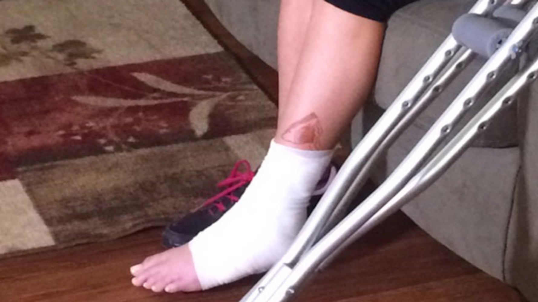 Photos: Seminole County girl bitten by shark