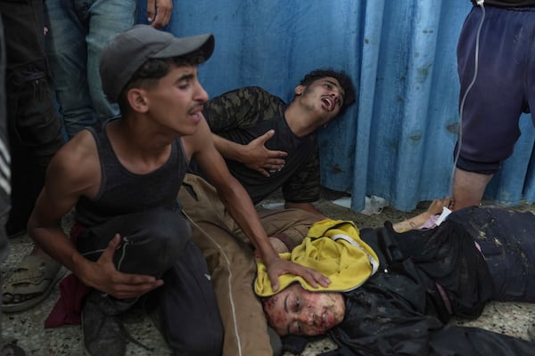 EDS NOTE: GRAPHIC CONTENT - Palestinians react beside their wounded sister, injured in an Israeli airstrike, as she brought to Shifa Hospital in Gaza City Saturday, July 12, 2025. (AP Photo/Jehad Alshrafi)