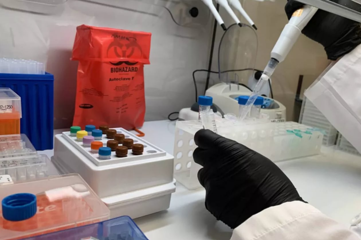 BioTouch, a company that manufactures medical testing kits, announced an expansion to its Columbus operations in December 2025. This is a courtesy photo of BioTouch's sample collection products. (Courtesy of BioTouch)