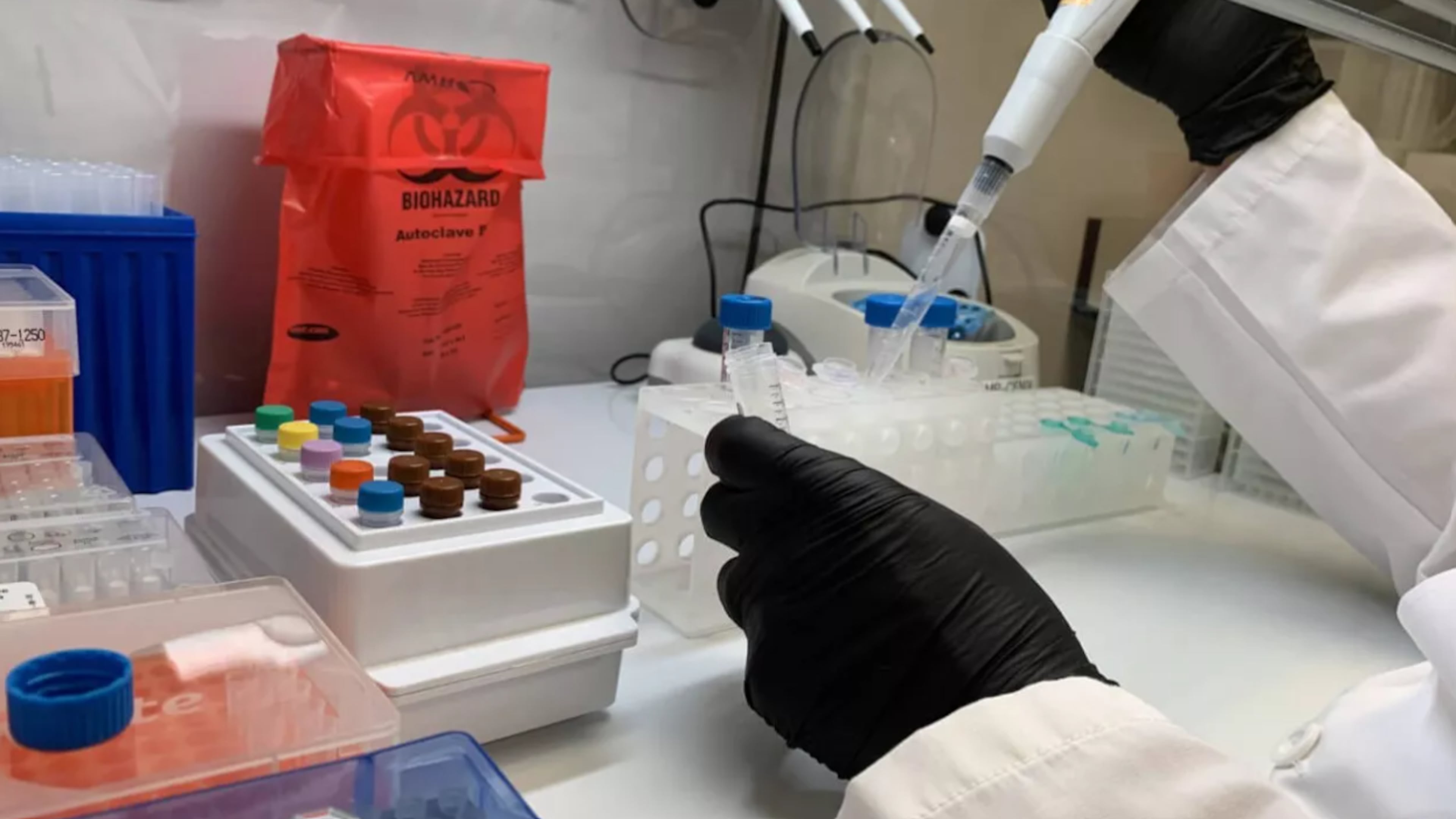 BioTouch, a company that manufactures medical testing kits, announced an expansion to its Columbus operations in December 2025. This is a courtesy photo of BioTouch's sample collection products. (Courtesy of BioTouch)