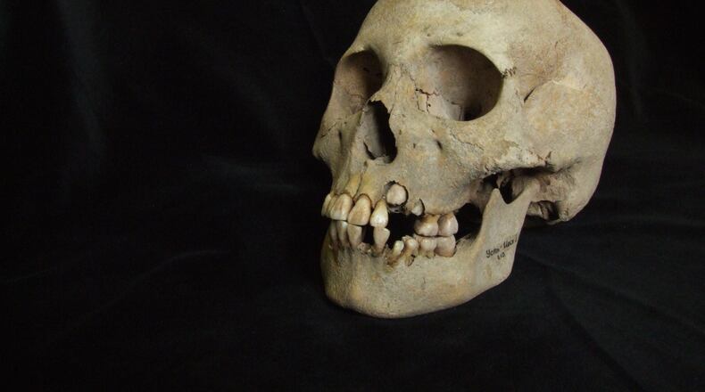 This 2006 image from Angela Lieverse shows the skull of a young girl who was buried with victims of the plague in Siberia. (Angela Lieverse via AP)