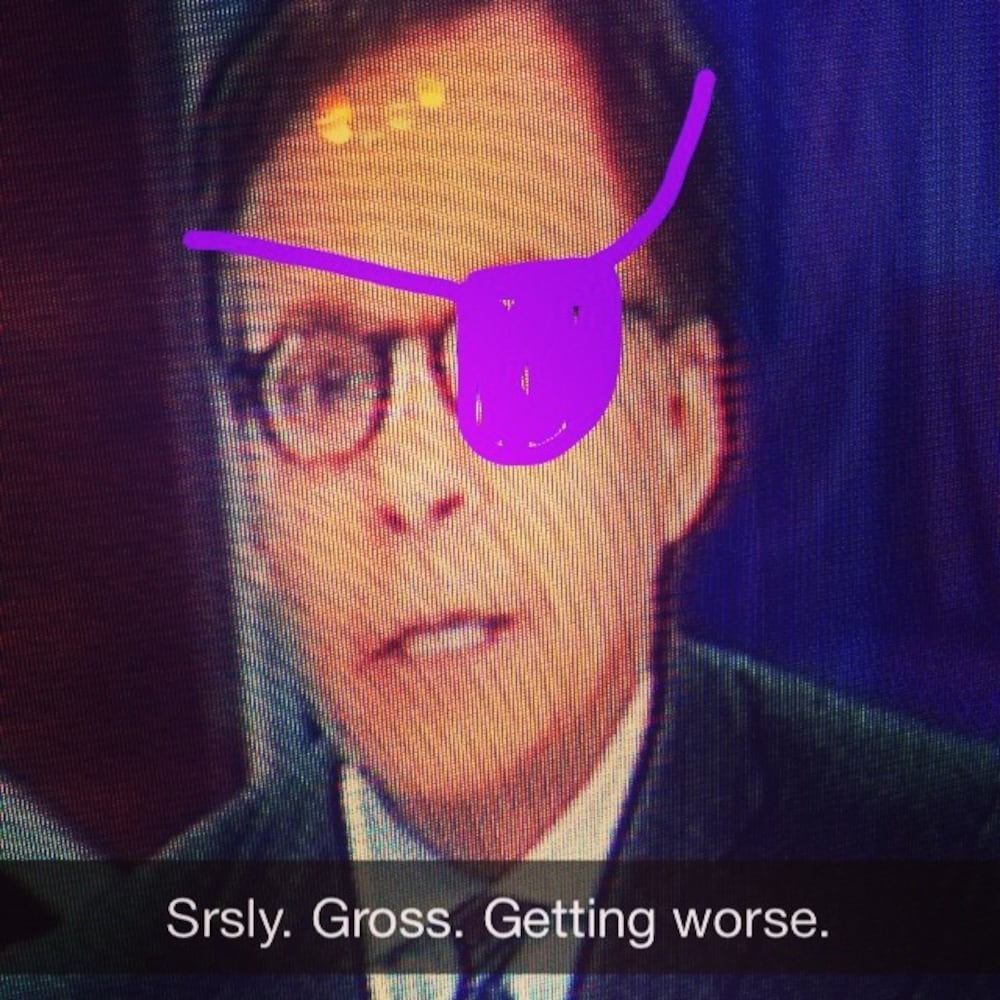 Get this man an eye patch! #sochi #bobcostas #pinkeye #shiteye #olympics Photo posted by @lindserkins