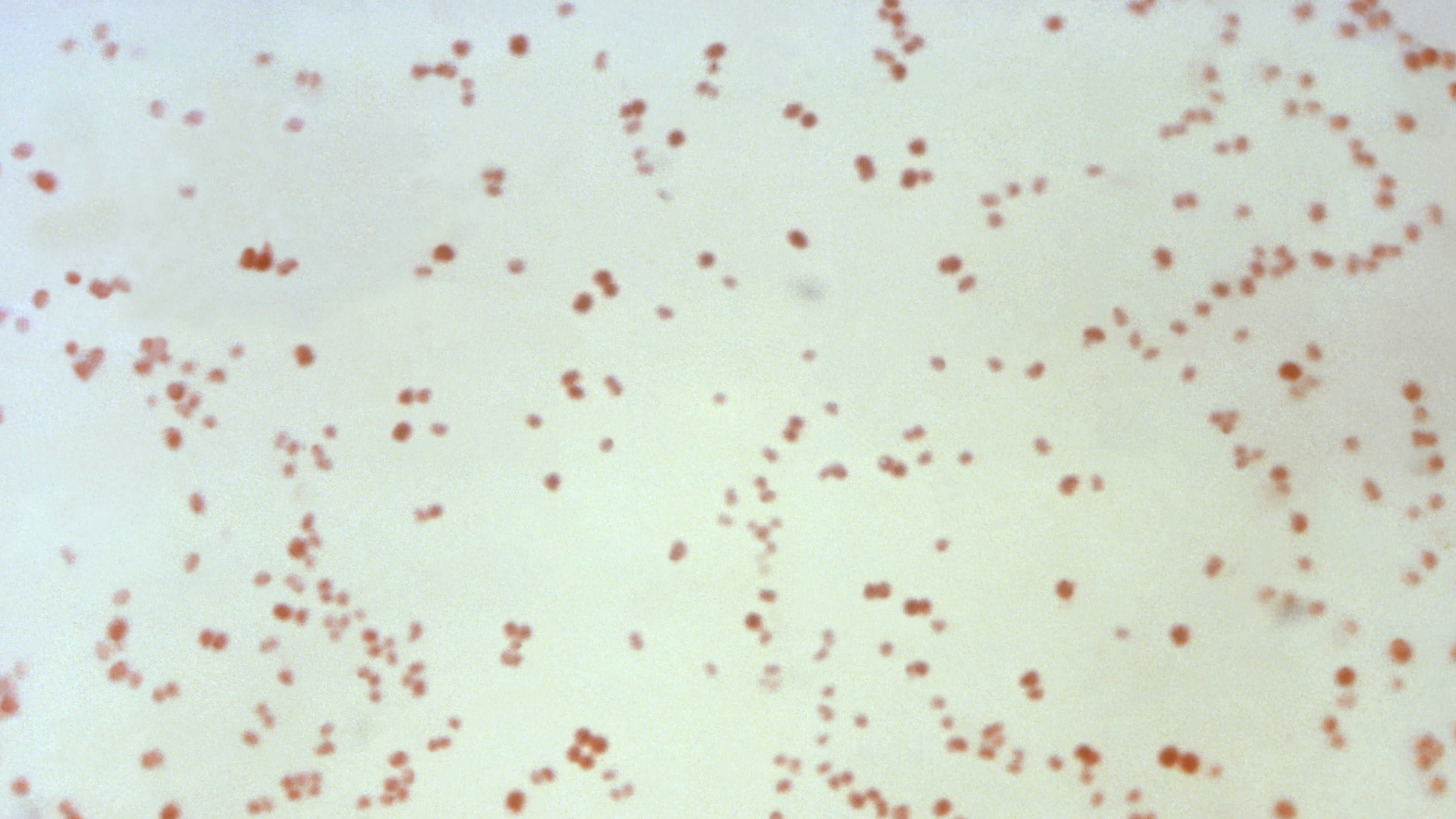 FILE - This 1971 microscope photo provided by the Centers for Disease Control and Prevention shows Neisseria gonorrhoeae bacteria, which causes the sexually-transmitted disease gonorrhea. (CDC via AP, File)