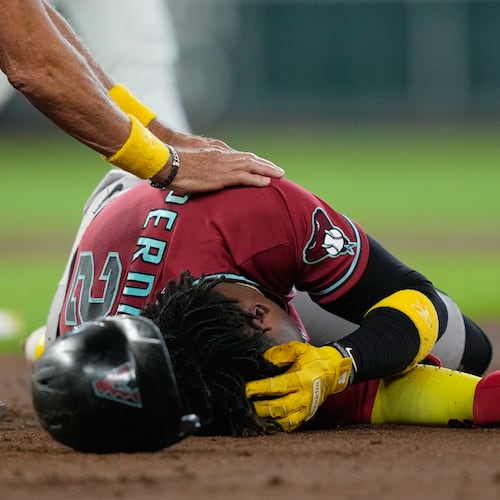 Arizona Diamondbacks' Geraldo Perdomo (2) holds his head after being hit by a line drive by Ketel Marte during the third inning of a baseball game against the Houston Astros Sunday, Sept. 6, 2026, in Houston. (AP Photo/David J. Phillip)