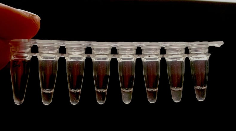 ID Genomic s technology quickly identifies bacteria, giving doctors information to select the appropriate treatment for a patient. (ID Genomics)