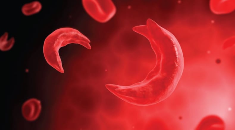 Understanding sickle cell disease