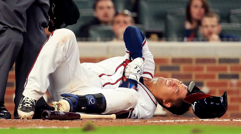 Kurt Suzuki reacts after being hit in the hand by a pitch in the second game of the season. (Photo by Daniel Shirey/Getty Images)