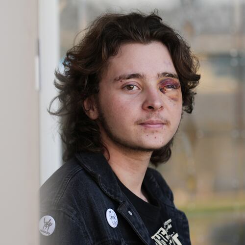Kaden Rummler, who was injured after being hit with a projectile fired by a federal agent during a protest outside an immigration building in Santa Ana, Calif., poses for a portrait Wednesday, Jan. 14, 2026, in Southern California. (AP Photo/Damian Dovarganes)
