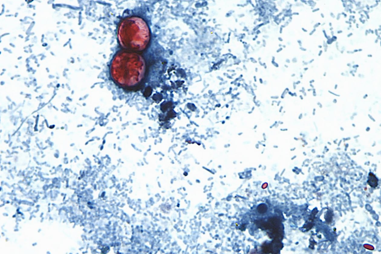 This undated photo taken through a microscope shows cyclospora cayetanensis oocysts. An outbreak of the diarrhea-causing parasite has spurred warnings from health officials. (Centers for Disease Control and Prevention via AP File)
