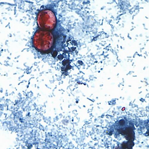 This undated photo taken through a microscope shows cyclospora cayetanensis oocysts. An outbreak of the diarrhea-causing parasite has spurred warnings from health officials. (Centers for Disease Control and Prevention via AP File)