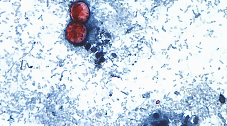 This undated photo taken through a microscope shows cyclospora cayetanensis oocysts. An outbreak of the diarrhea-causing parasite has spurred warnings from health officials. (Centers for Disease Control and Prevention via AP File)