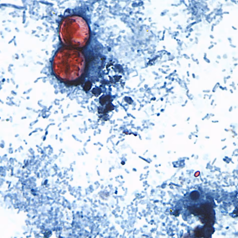 This undated photo taken through a microscope shows cyclospora cayetanensis oocysts. An outbreak of the diarrhea-causing parasite has spurred warnings from health officials. (Centers for Disease Control and Prevention via AP File)