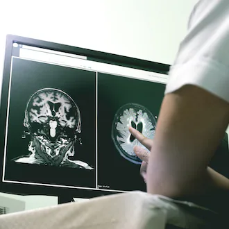 The My ALZ Journey app, developed in partnership with those who have early stage Alzheimer’s, caters to the idea that everyone navigating the disease has different preferences in accessing services and support. (Dreamstime/TNS)