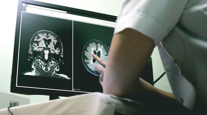 The My ALZ Journey app, developed in partnership with those who have early stage Alzheimer’s, caters to the idea that everyone navigating the disease has different preferences in accessing services and support. (Dreamstime/TNS)