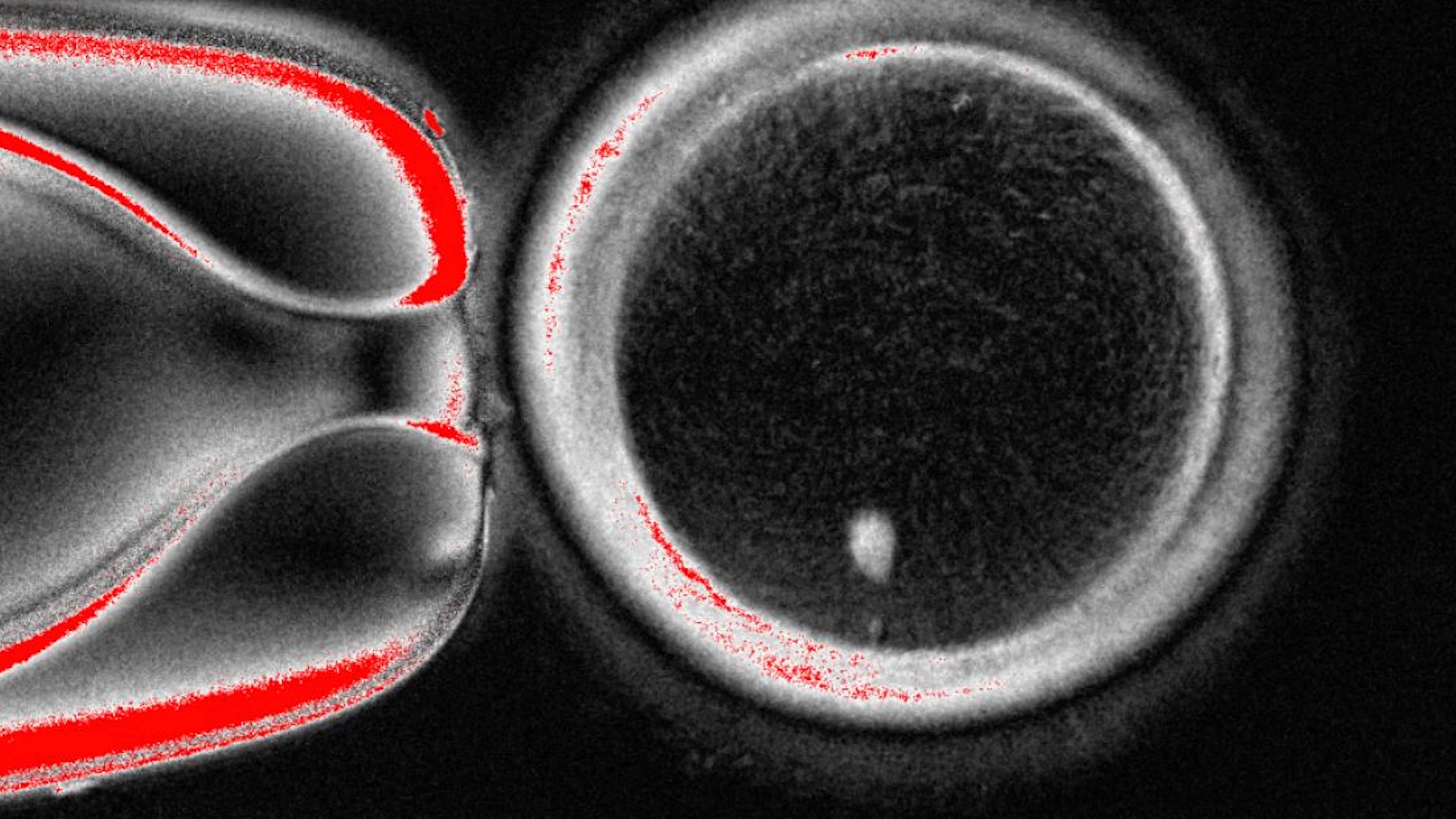 This undated image provided by the Mitalipov Laboratory at Oregon Health & Science University shows a a microscope image of a human egg that contains a nucleus taken from a skin cell. (Mitalipov Laboratory via AP)