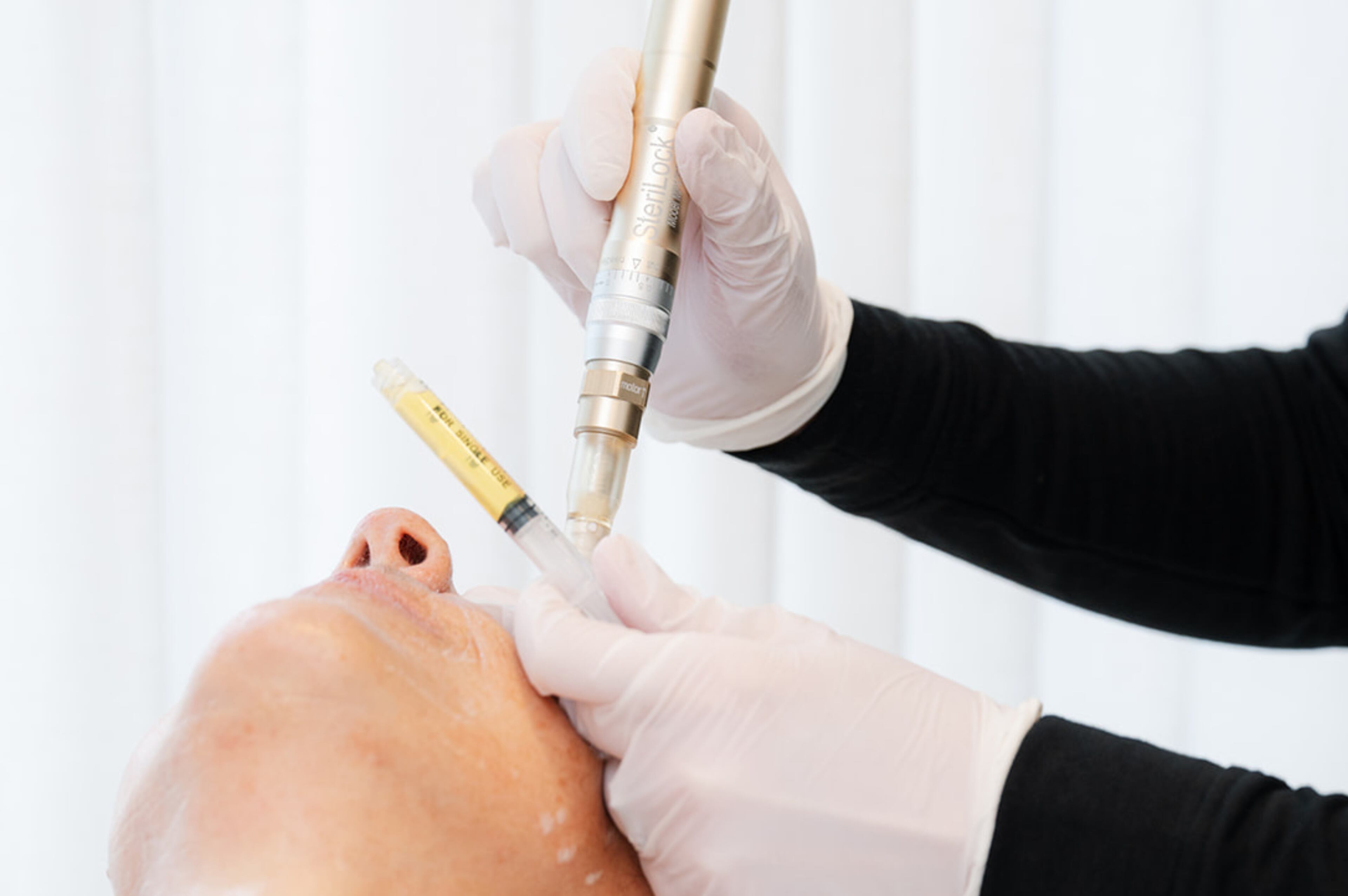 Why you should try a ‘vampire facial’ this fall