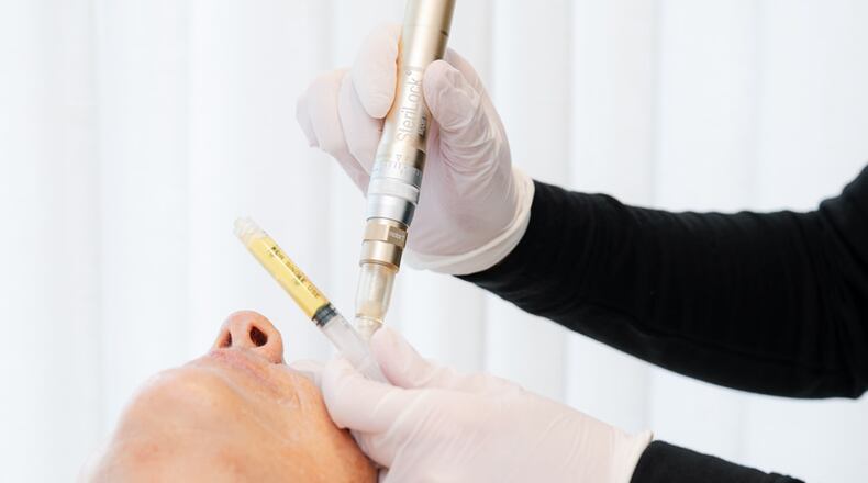 During a PRP facial, platelet-rich plasma — often called “liquid gold” for its regenerative properties — is applied to freshly microneedled skin to encourage healing and radiance.