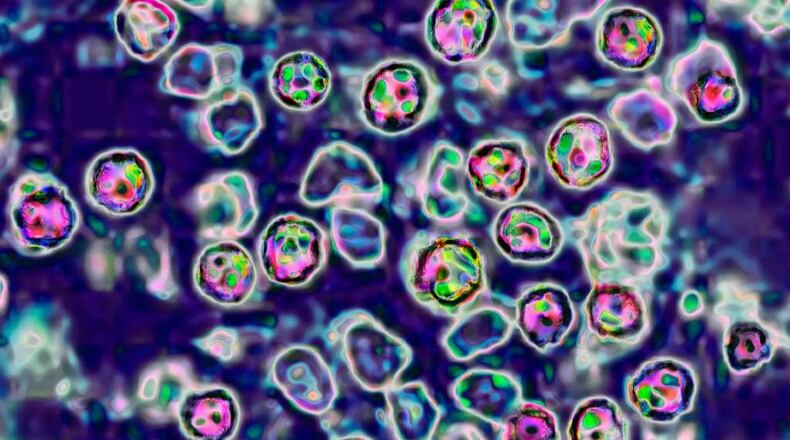 The measles virus, paramyxoviridae from the Morbillivirus family, seen under a microscope.