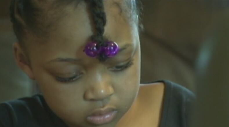 Jamie underwent a liver transplant recently. Now donations are needed so a family can enlarge their home, paving the way to adopt Jamie and her siblings.