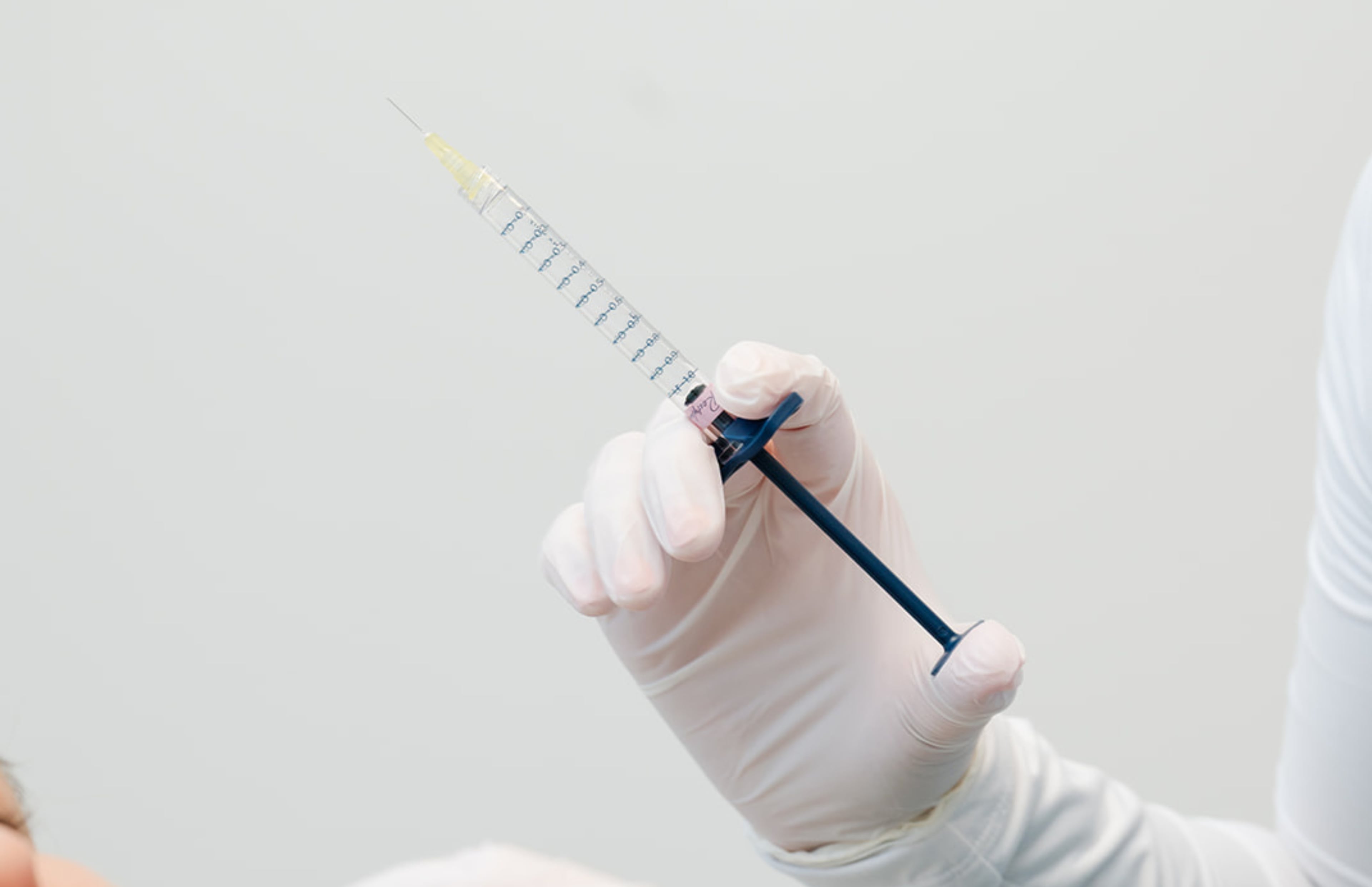 Platelet-rich plasma, drawn from the patient’s blood and spun in a centrifuge, is applied to the skin during microneedling to stimulate new collagen and restore a healthy glow.