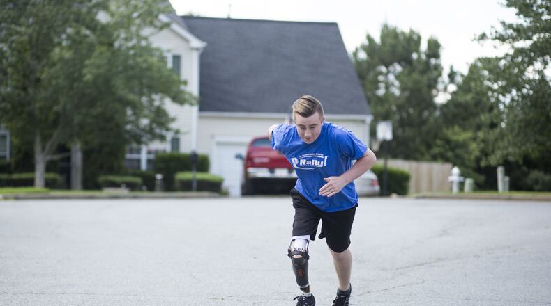 Matthew McMahon begins a jog, practicing for his triathlon in August, in his neighborhood in Woodstock recently. In 2014, McMahon was diagnosed with bone cancer. This not only required intensive treatment, but also the amputation of his right leg from the knee down. McMahon, who is in remission, wears a prosthesis. On June 25, McMahon, who competed in his first post-diagnosis triathlon last August, will serve as emcee for the seventh annual PT Solutions Allatoona Triathlon. Proceeds will benefit the Rally Foundation for Childhood Cancer Research. CHAD RHYM / CHAD.RHYM@AJC.COM