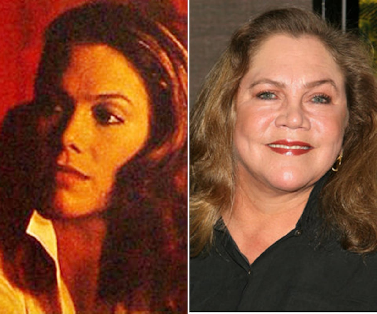 Celebrities who didn't age gracefully