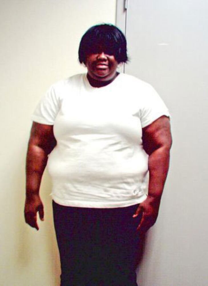 Best weight loss success stories of 2010