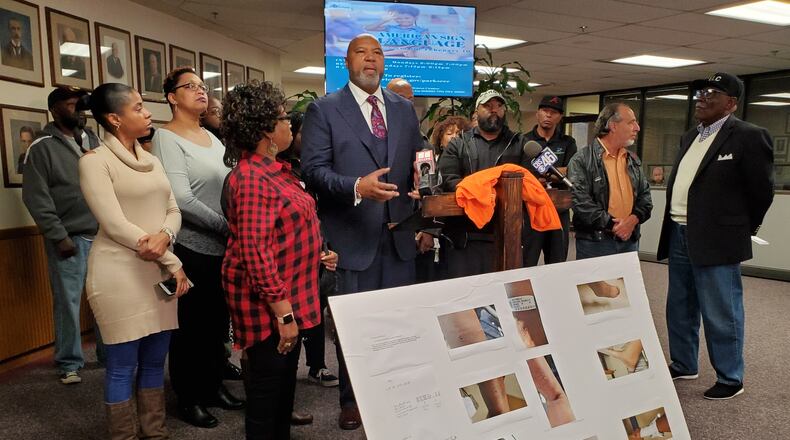 Marietta City Councilman Reggie Copeland, center, held a press conference to call on the Police Department to address excessive use of force against minorities. Copeland shared images of injuries he say he suffered after he was pulled from his vehicle and handcuffed following a May 24 traffic collision.