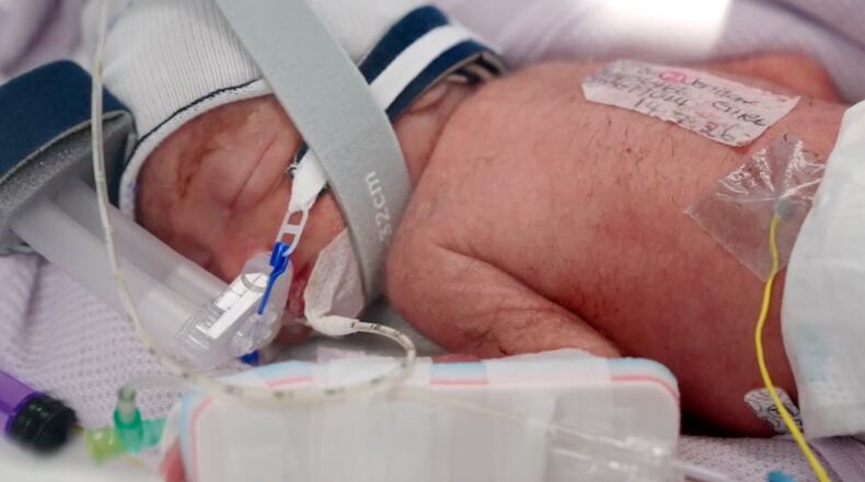 In this image taken from video taken on July 15, 2026, one of the quadruplets born at Metro North Health hospital lies in an incubator in Brisbane, Australia. (Metro North Health via AP)