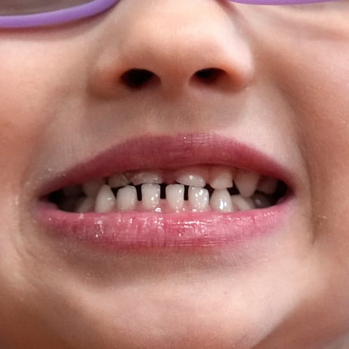 FILE - A child shows off her teeth after a dental exam in Concord, N.H., Wednesday, Feb. 21, 2024. (AP Photo/Robert F. Bukaty, file)