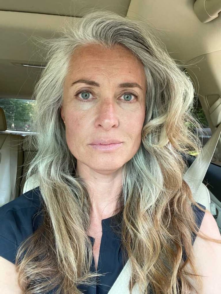 Gray hair