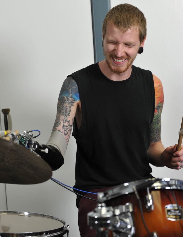 Jason Barnes and the robotic prosthesis