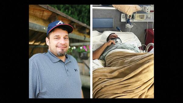Travis Abbott was hit with a steel bar during a road-rage incident in Spalding County. Photo: Channel 2 Action News
