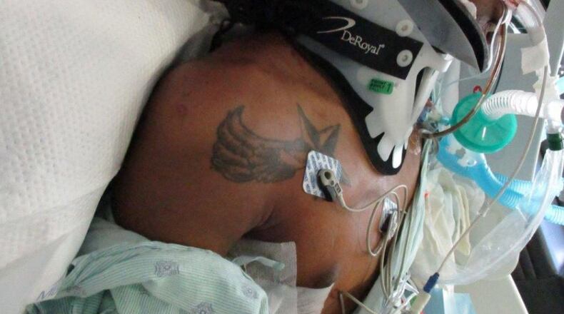 The armed robbery suspect on life support.