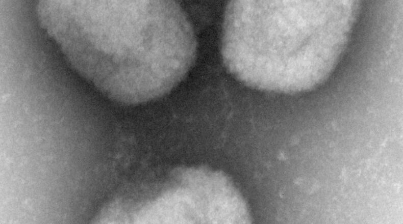 Microscope image of a new virus known as Akhmeta, after the eastern European region where it was first detected. The germ is related to the dreaded smallpox and monkeypox viruses but so far seems far less threatening. A Dallas resident has been hospitalized in stable condition under isolation after returning from Nigeria with the first Texas case of monkeypox, health officials revealed Friday. (AP Photo/CDC via The New England Journal of Medicine, Cynthia Goldsmith, Maureen Metcalfe)