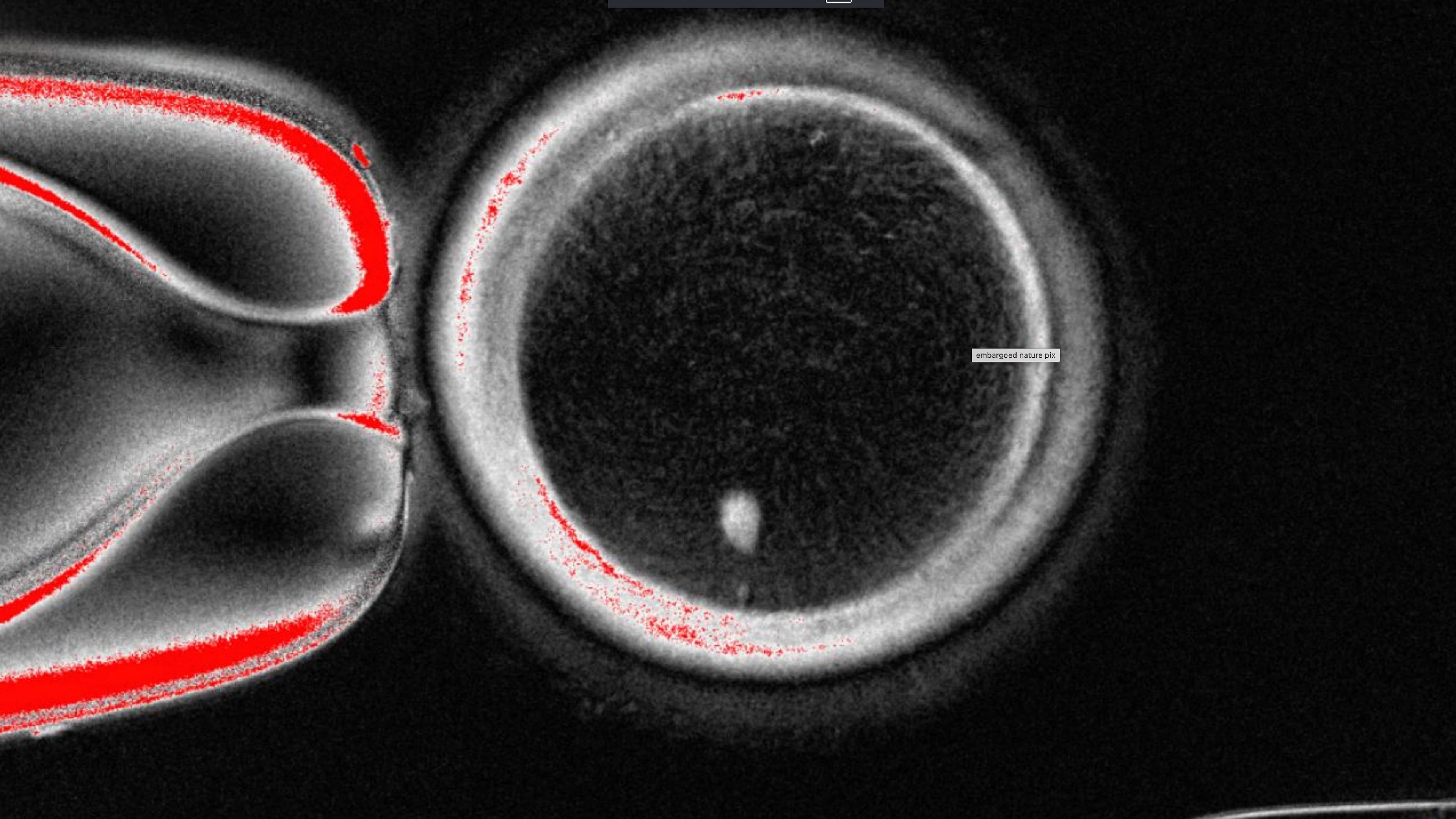 This undated image provided by the Mitalipov Laboratory at Oregon Health & Science University shows a a microscope image of a human egg that contains a nucleus taken from a skin cell. (Mitalipov Laboratory via AP)