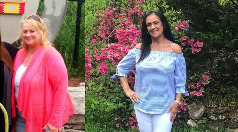 In the photo on the left, taken in 2017, Karen Uyttenhove weighed 284 pounds. In the photo on the right, taken in 2020, she weighed 188 pounds. (Photos contributed by Karen Uyttenhove)