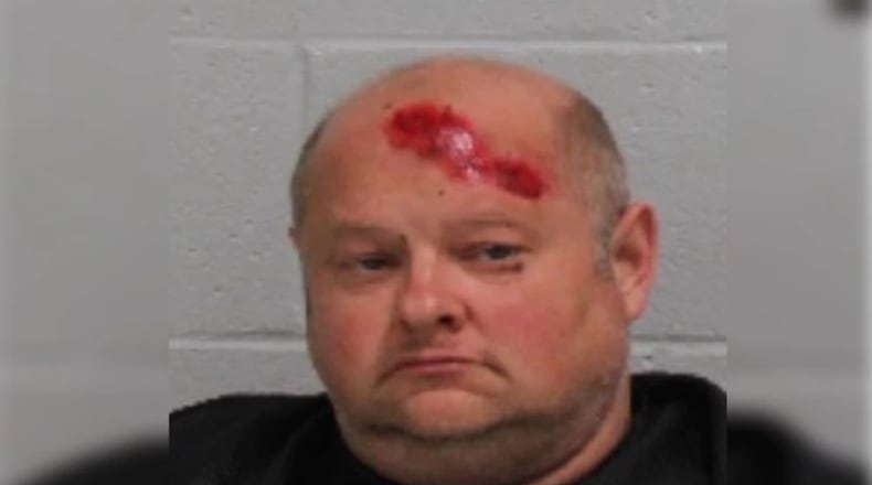 Richard Sigman shot and killed an 18-year-old after firing his gun into a parked vehicle early Saturday, according to Carrollton police. Sigman's injury, shown in the photo, was already present when police located him, they told Channel 2 Action News.