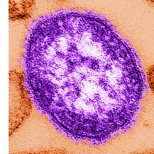FILE - This undated image made available by the Centers for Disease Control and Prevention on Feb. 4, 2015, shows an electron microscope image of a measles virus particle. (Cynthia Goldsmith/Centers for Disease Control and Prevention, via AP, File)