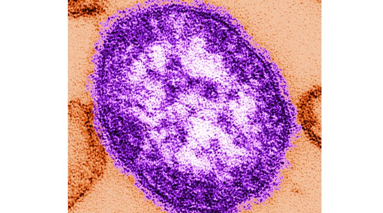 FILE - This undated image made available by the Centers for Disease Control and Prevention on Feb. 4, 2015, shows an electron microscope image of a measles virus particle. (Cynthia Goldsmith/Centers for Disease Control and Prevention, via AP, File)