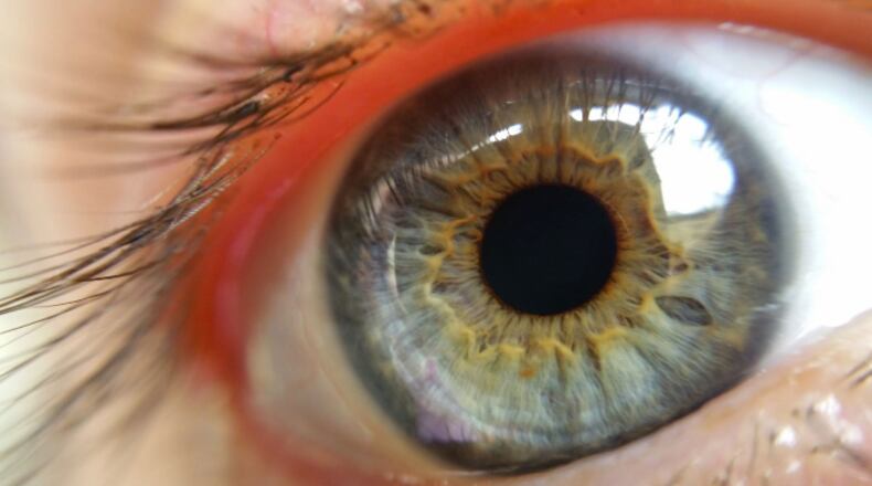 File photo of an eye