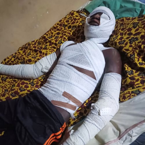 In this photo released by Amnesty International Nigeria, a patient receives treatment at the Yariman Bakura Specialist hospital in Gusau, Nigeria, Monday, May 11, 2026, after a Nigerian military airstrike struck a market on Sunday. (Amnesty International Nigeria Via AP)