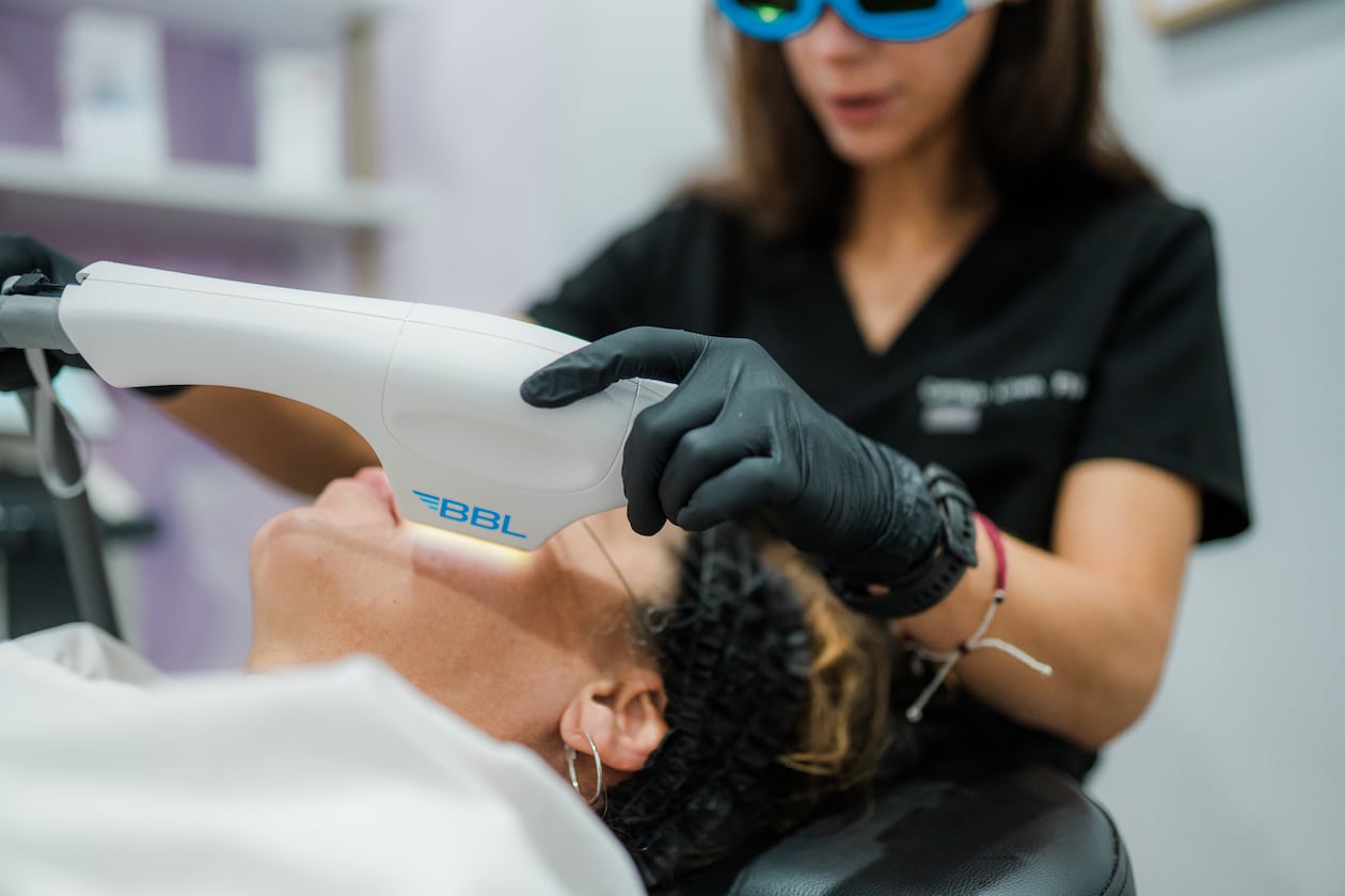 A provider administers a BBL broadband light treatment at The Beauty Barn in Milton, Georgia. (Courtesy of The Beauty Barn)