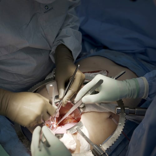 FILE - Surgeons at NYU Langone Health prepare to transplant a pig's kidney into a brain-dead man in New York on July 14, 2023. (AP Photo/Shelby Lum, File)